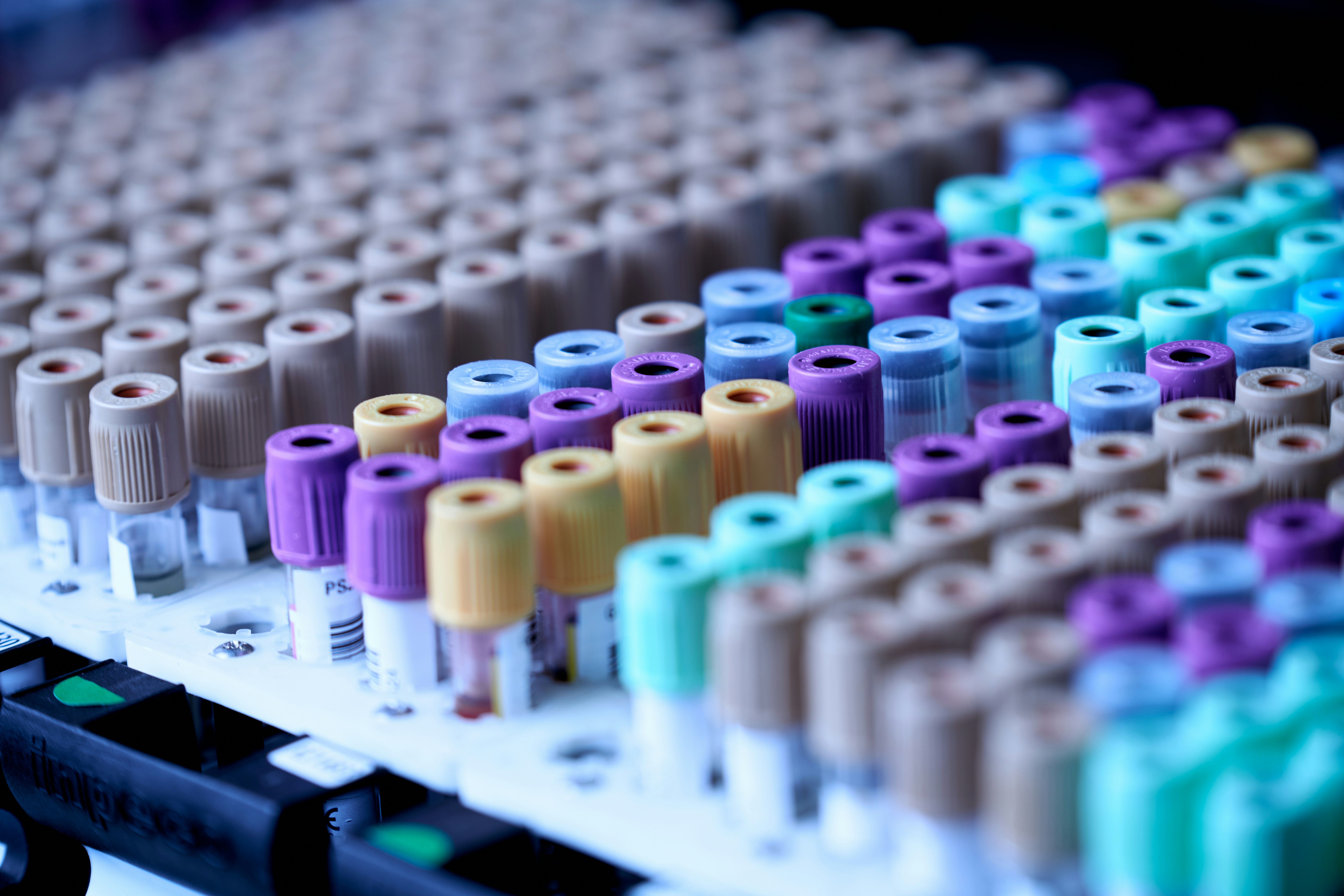 Single-cell PBMC Analysis